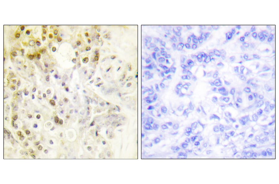 Immunohistochemistry - Anti-Cyclin L1 Antibody (C0295) - Antibodies.com
