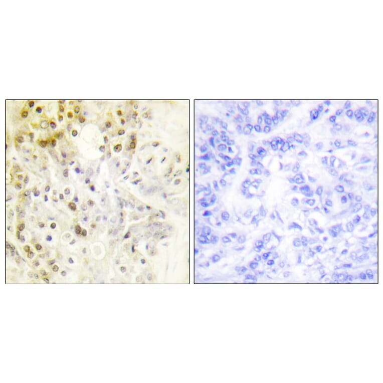 Immunohistochemistry - Anti-Cyclin L1 Antibody (C0295) - Antibodies.com