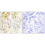 Immunohistochemistry - Anti-Cyclin L1 Antibody (C0295) - Antibodies.com