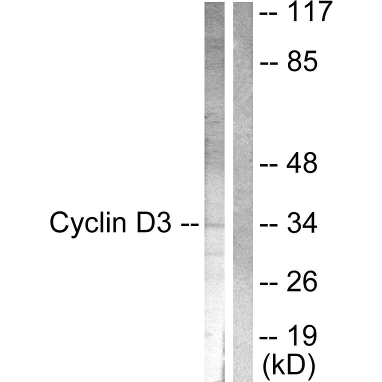 Western Blot - Anti-Cyclin D3 Antibody (B0418) - Antibodies.com