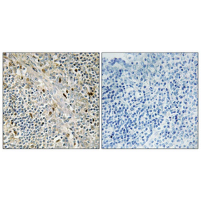 Immunohistochemistry - Anti-Cyclin D3 Antibody (B0418) - Antibodies.com