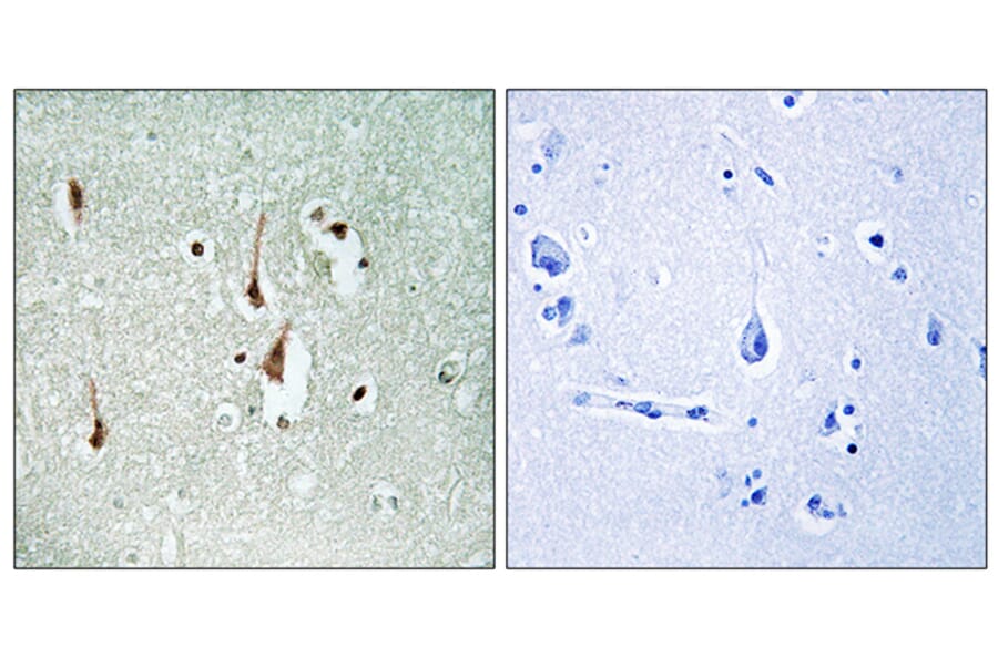 Immunohistochemistry - Anti-Cyclin D1 Antibody (B0417) - Antibodies.com
