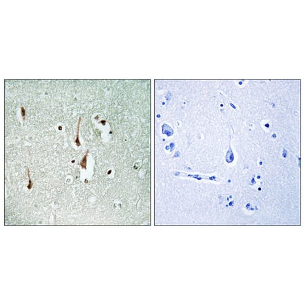 Immunohistochemistry - Anti-Cyclin D1 Antibody (B0417) - Antibodies.com