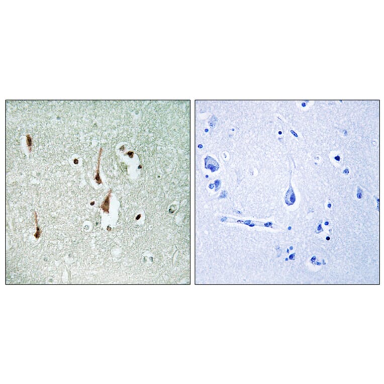 Immunohistochemistry - Anti-Cyclin D1 Antibody (B0417) - Antibodies.com