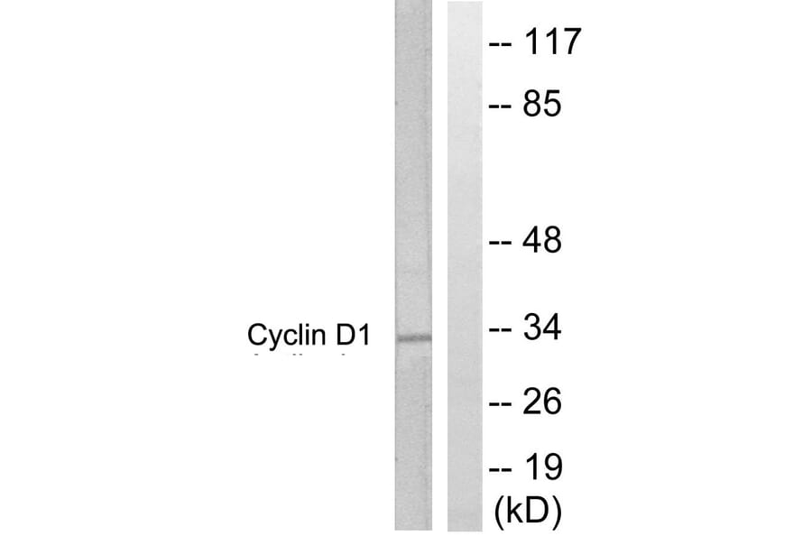 Western Blot - Anti-Cyclin D1 Antibody (B0417) - Antibodies.com