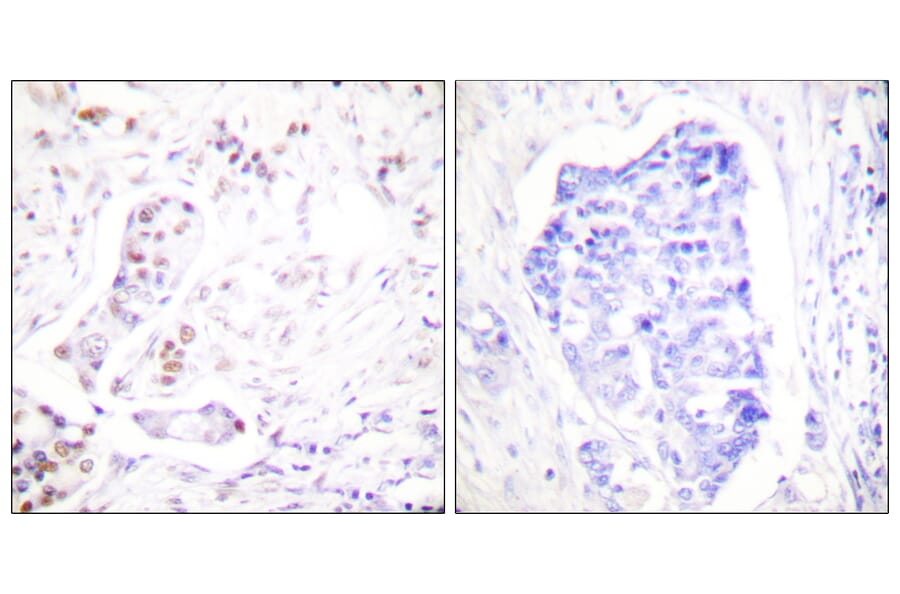 Immunohistochemistry - Anti-Cyclin A1 Antibody (C0166) - Antibodies.com