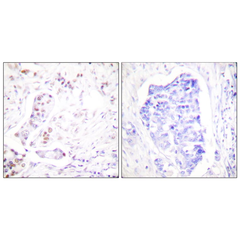 Immunohistochemistry - Anti-Cyclin A1 Antibody (C0166) - Antibodies.com