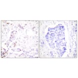 Immunohistochemistry - Anti-Cyclin A1 Antibody (C0166) - Antibodies.com