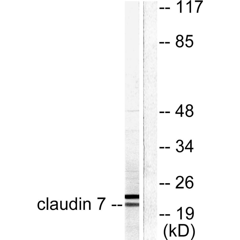 Western Blot - Anti-Claudin 7 Antibody (C0153) - Antibodies.com