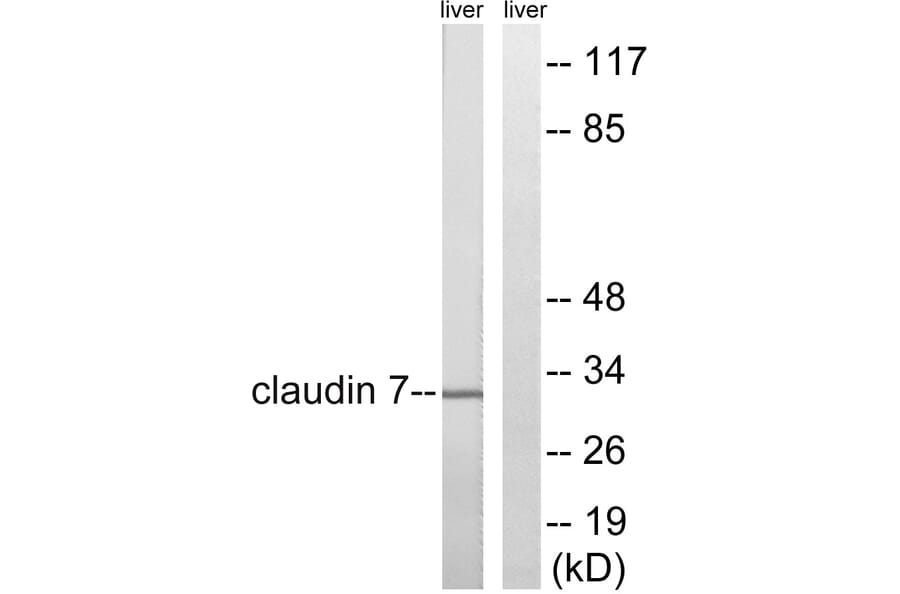 Western Blot - Anti-Claudin 7 Antibody (B8321) - Antibodies.com