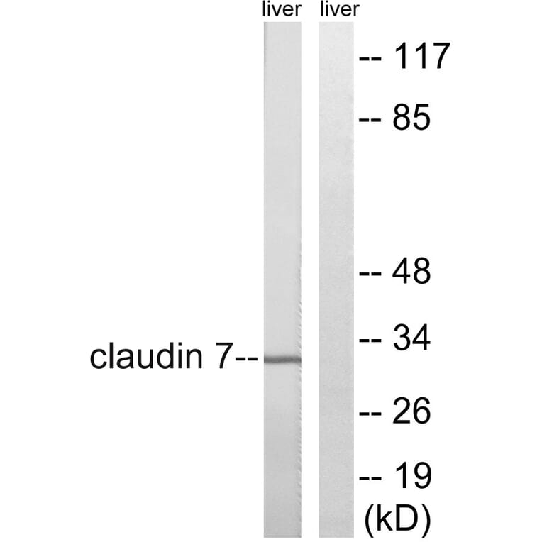 Western Blot - Anti-Claudin 7 Antibody (B8321) - Antibodies.com