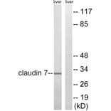 Western Blot - Anti-Claudin 7 Antibody (B8321) - Antibodies.com