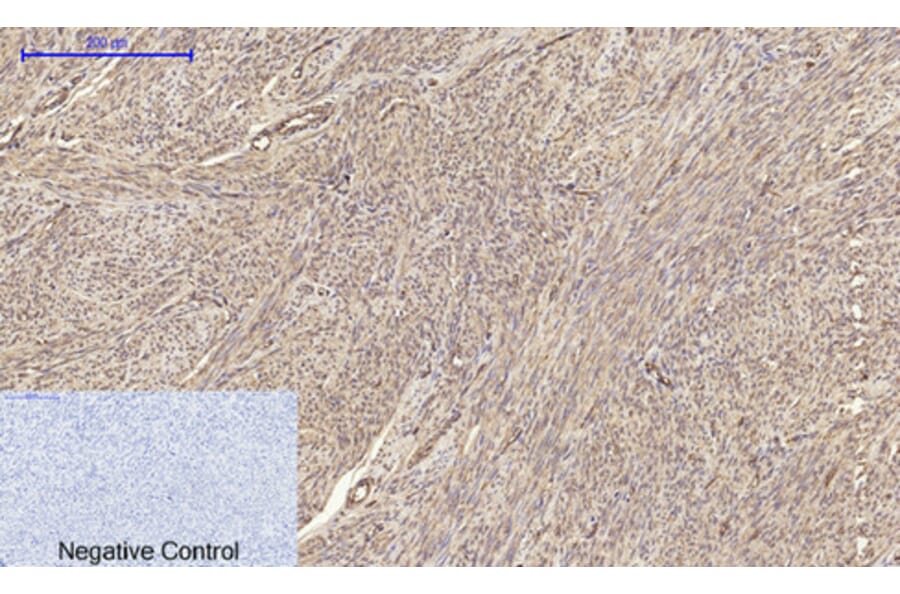 Immunohistochemistry - Anti-Claudin 5 Antibody (C0145) - Antibodies.com