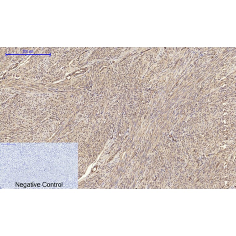 Immunohistochemistry - Anti-Claudin 5 Antibody (C0145) - Antibodies.com