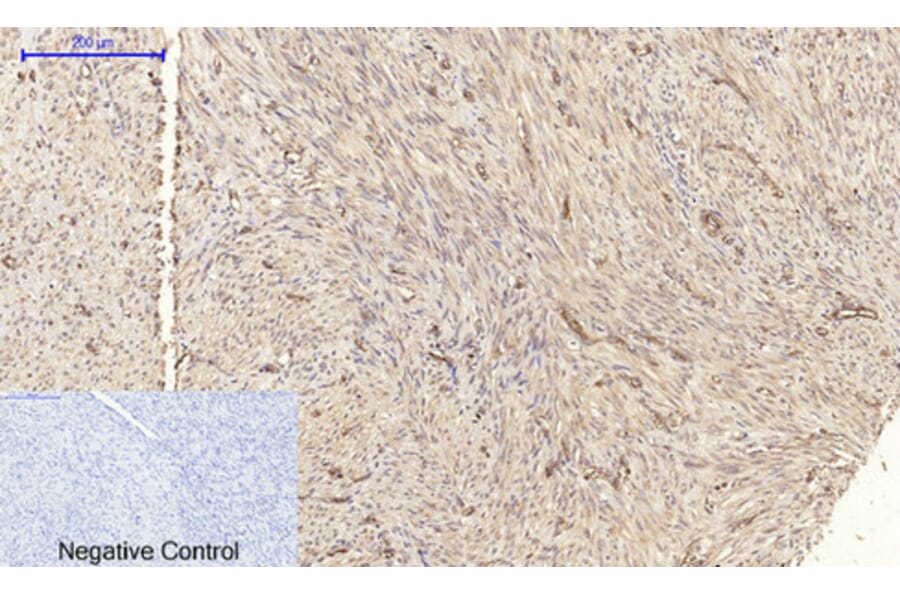 Immunohistochemistry - Anti-Claudin 5 Antibody (C0145) - Antibodies.com