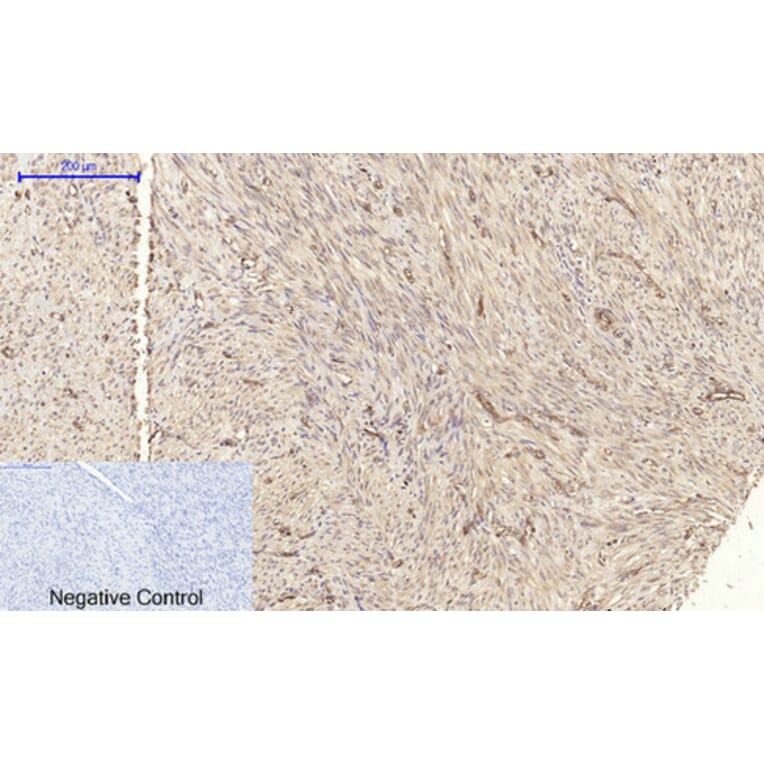 Immunohistochemistry - Anti-Claudin 5 Antibody (C0145) - Antibodies.com
