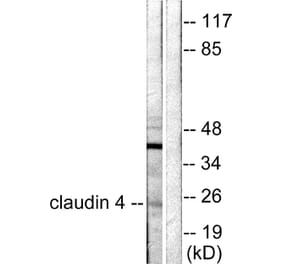 Western Blot - Anti-Claudin 4 Antibody (C0141) - Antibodies.com