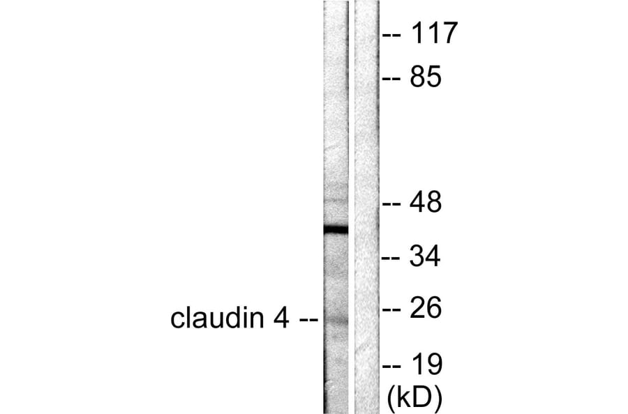 Western Blot - Anti-Claudin 4 Antibody (C0141) - Antibodies.com