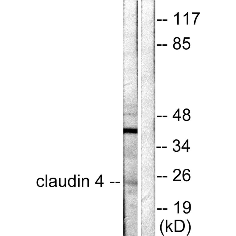 Western Blot - Anti-Claudin 4 Antibody (C0141) - Antibodies.com