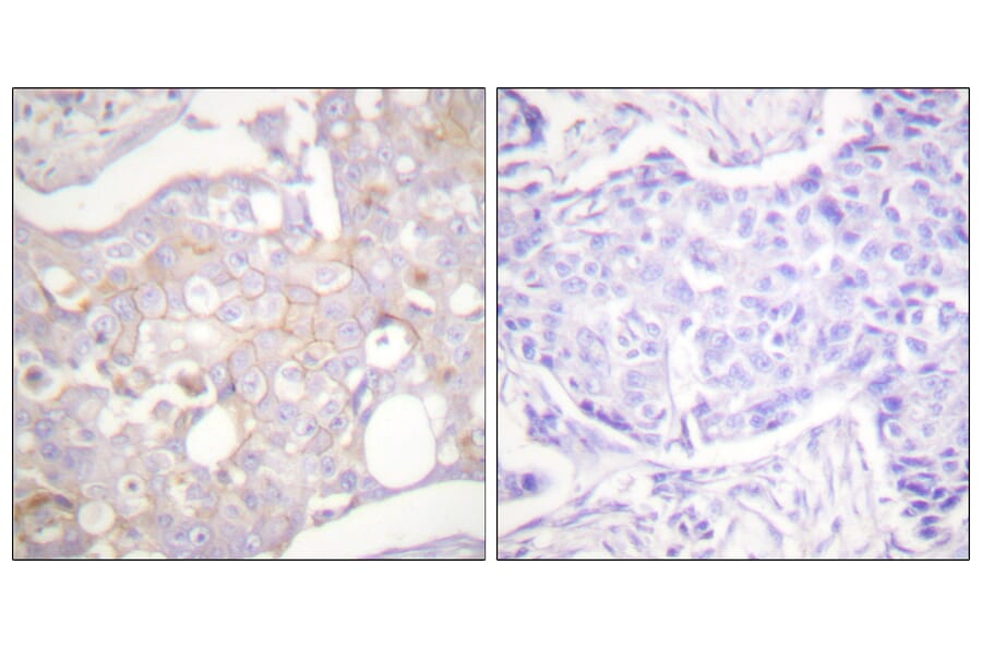 Immunohistochemistry - Anti-Claudin 4 Antibody (C0141) - Antibodies.com