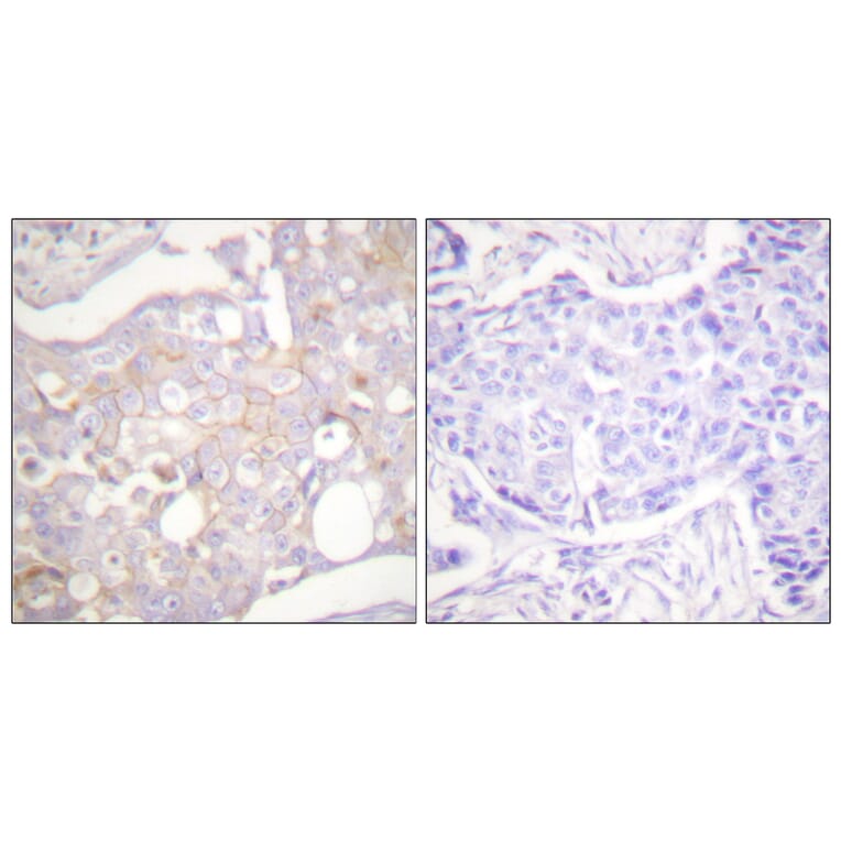 Immunohistochemistry - Anti-Claudin 4 Antibody (C0141) - Antibodies.com