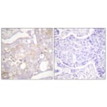 Immunohistochemistry - Anti-Claudin 4 Antibody (C0141) - Antibodies.com