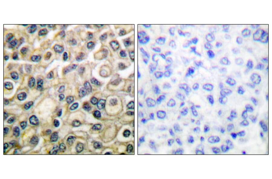 Immunohistochemistry - Anti-Claudin 1 Antibody (C0142) - Antibodies.com