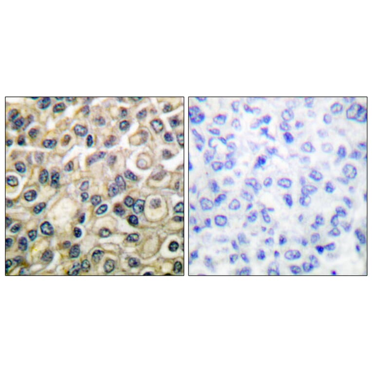Immunohistochemistry - Anti-Claudin 1 Antibody (C0142) - Antibodies.com