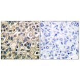 Immunohistochemistry - Anti-Claudin 1 Antibody (C0142) - Antibodies.com