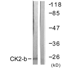 Western Blot - Anti-CKII-beta Antibody (B0869) - Antibodies.com