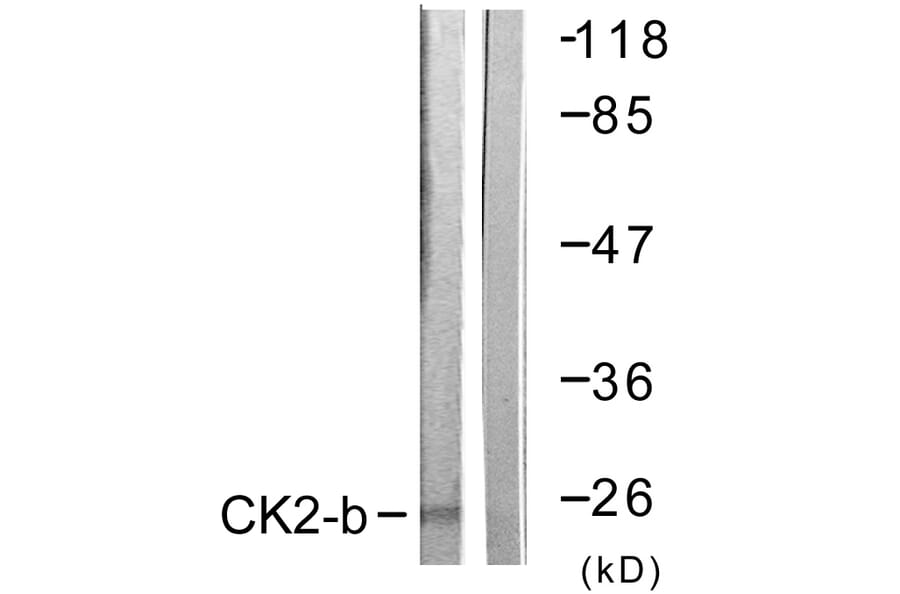Western Blot - Anti-CKII-beta Antibody (B0869) - Antibodies.com