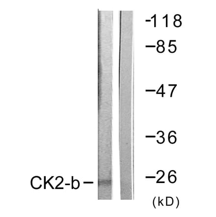 Western Blot - Anti-CKII-beta Antibody (B0869) - Antibodies.com