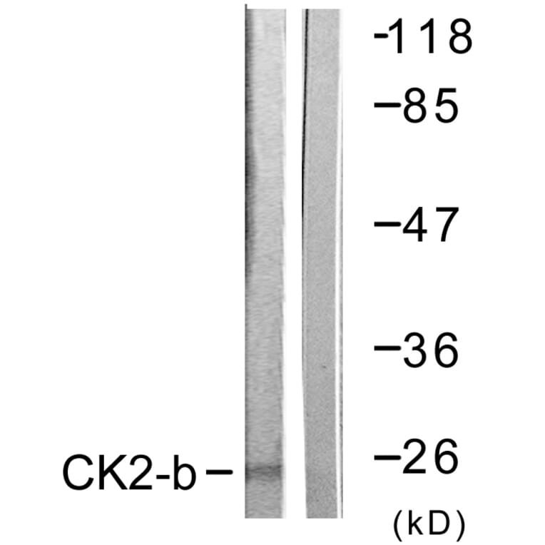 Western Blot - Anti-CKII-beta Antibody (B0869) - Antibodies.com
