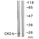 Western Blot - Anti-CKII-beta Antibody (B0869) - Antibodies.com