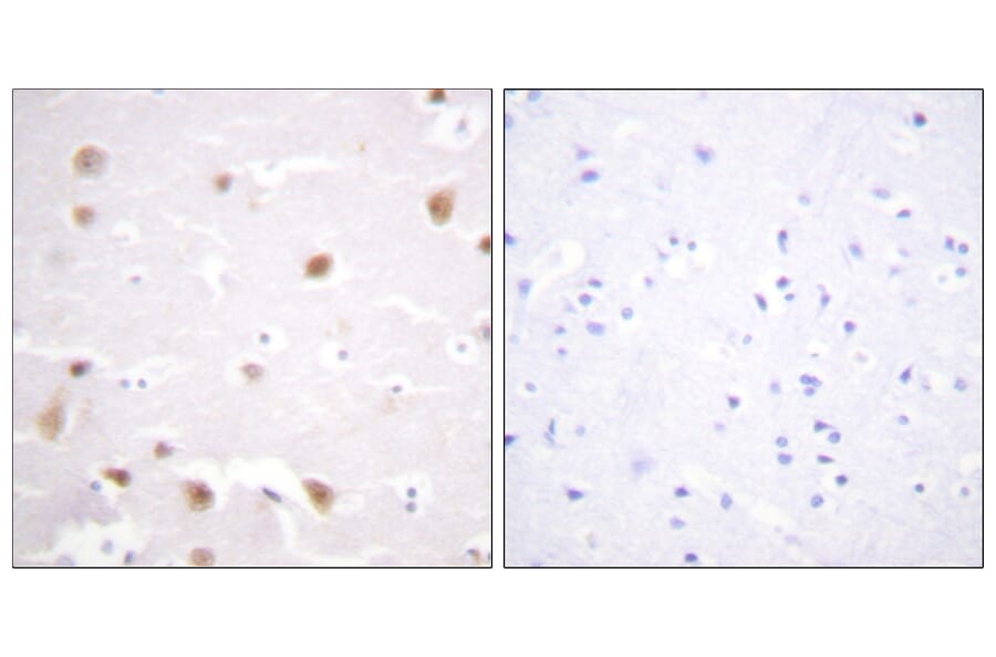 Immunohistochemistry - Anti-CKII-beta Antibody (B0869) - Antibodies.com