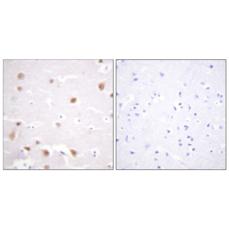 Immunohistochemistry - Anti-CKII-beta Antibody (B0869) - Antibodies.com