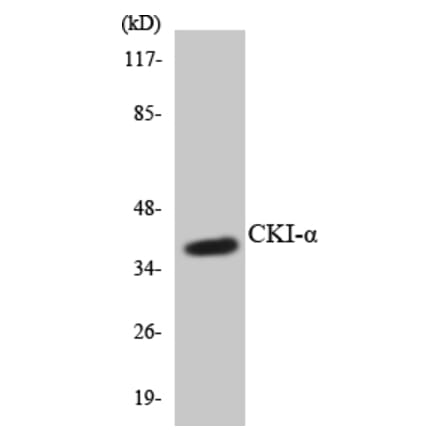 Western Blot - Anti-CKI-alpha Antibody (R12-2621) - Antibodies.com