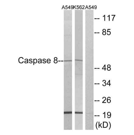 Western Blot - Anti-Caspase 8 Antibody (B0059) - Antibodies.com