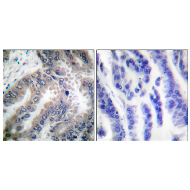 Immunohistochemistry - Anti-Caspase 8 Antibody (B0059) - Antibodies.com