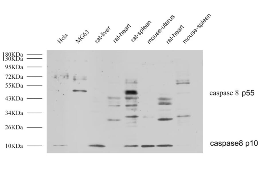 Western Blot - Anti-Caspase 8 Antibody (B0059) - Antibodies.com