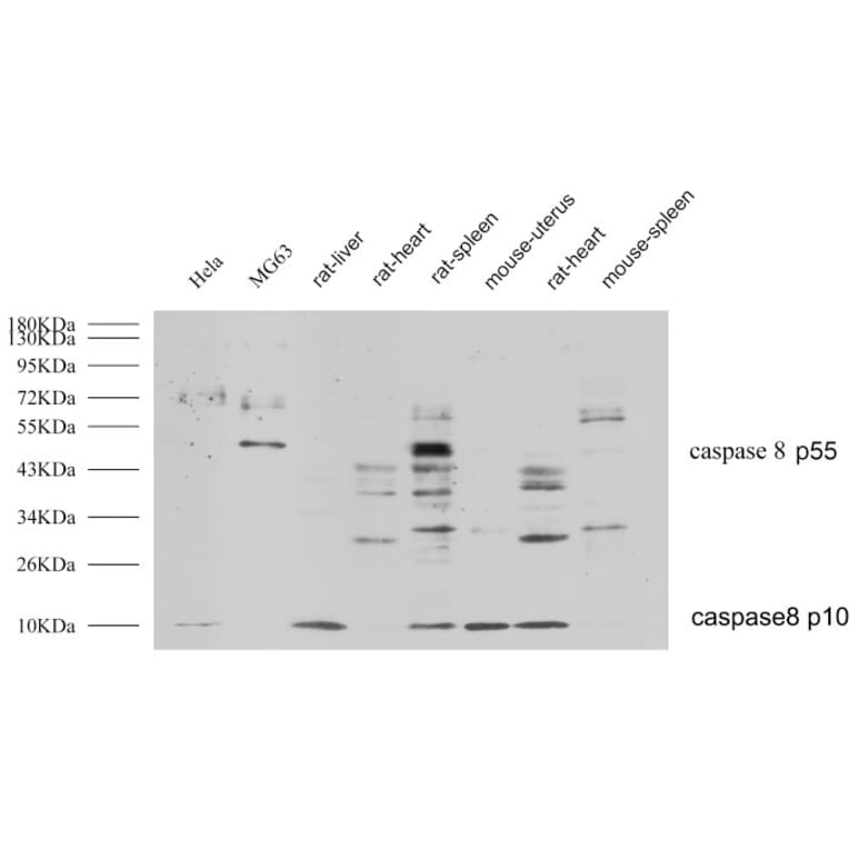 Western Blot - Anti-Caspase 8 Antibody (B0059) - Antibodies.com
