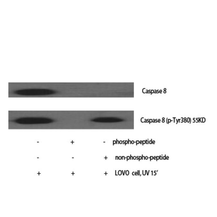 Western Blot - Anti-Caspase 8 Antibody (B0059) - Antibodies.com