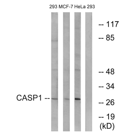 Western Blot - Anti-Caspase 1 Antibody (B1025) - Antibodies.com