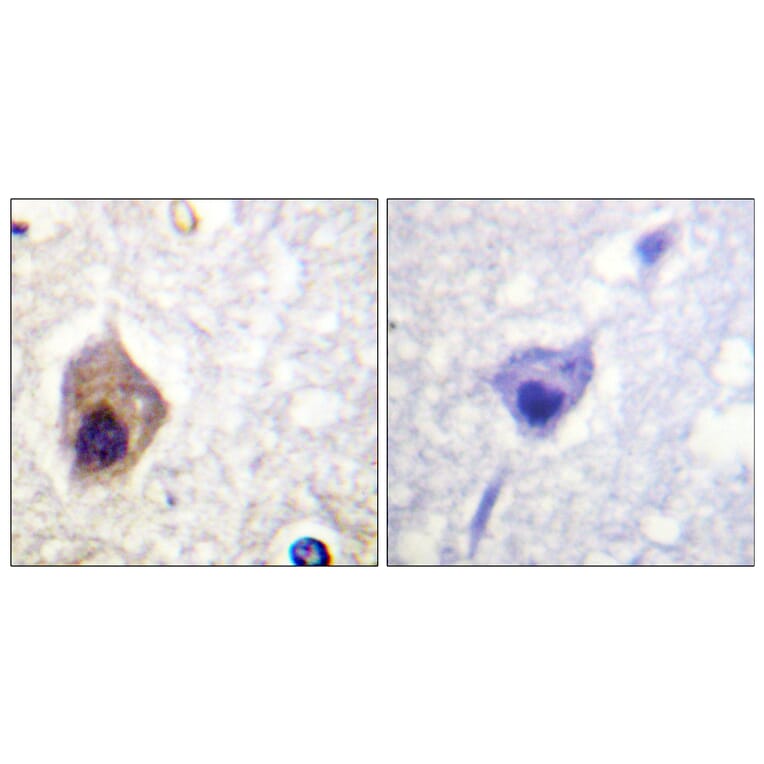 Immunohistochemistry - Anti-Caspase 1 Antibody (B1025) - Antibodies.com