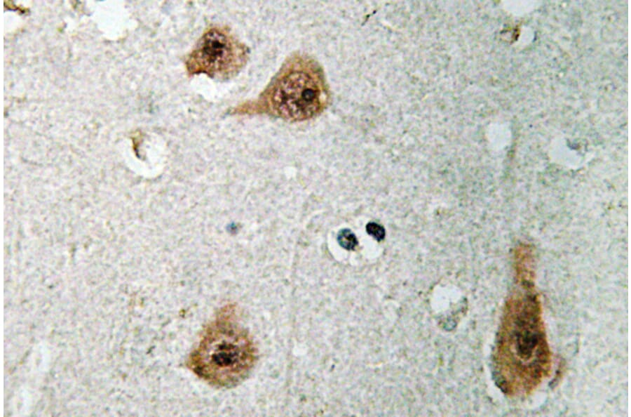 Immunohistochemistry - Anti-Annexin I Antibody (R12-2022) - Antibodies.com