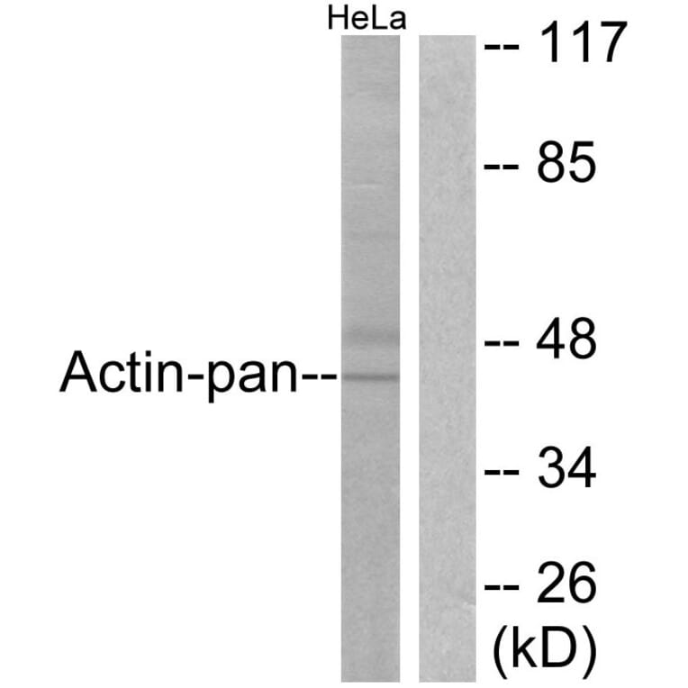 Western Blot - Anti-Actin-pan Antibody (C0124) - Antibodies.com