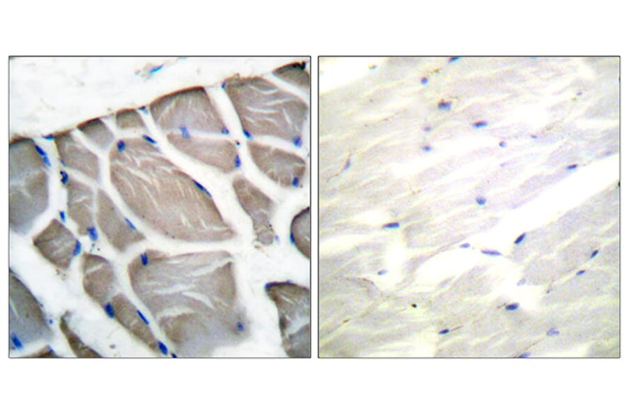 Immunohistochemistry - Anti-Actin-pan Antibody (C0124) - Antibodies.com