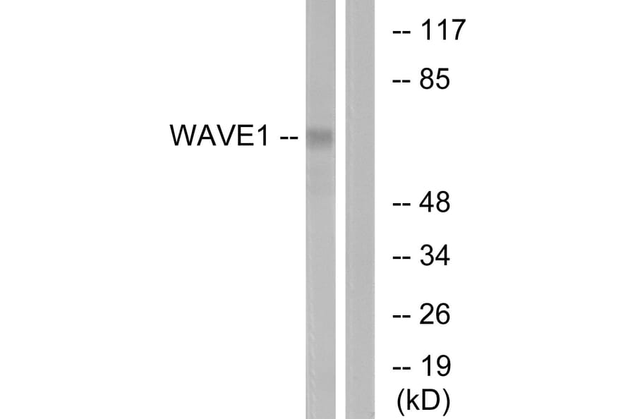Western Blot - Anti-WAVE1 Antibody (B0598) - Antibodies.com