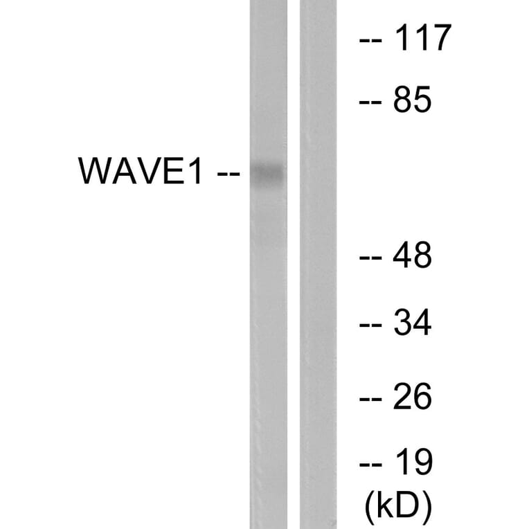 Western Blot - Anti-WAVE1 Antibody (B0598) - Antibodies.com