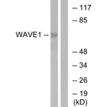 Western Blot - Anti-WAVE1 Antibody (B0598) - Antibodies.com
